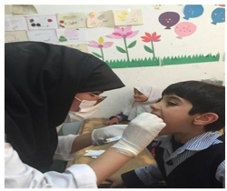 بهرمندی 6 هزار دانش آموز  از خدمات دندانپزشکی رایگان