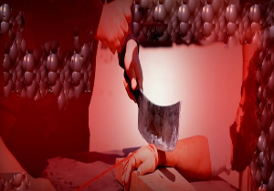 ماجرای عجیب پسری که دست خودش را قطع کرد