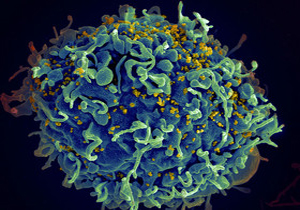 درمان کامل HIV با روش «شوک و کشتن»