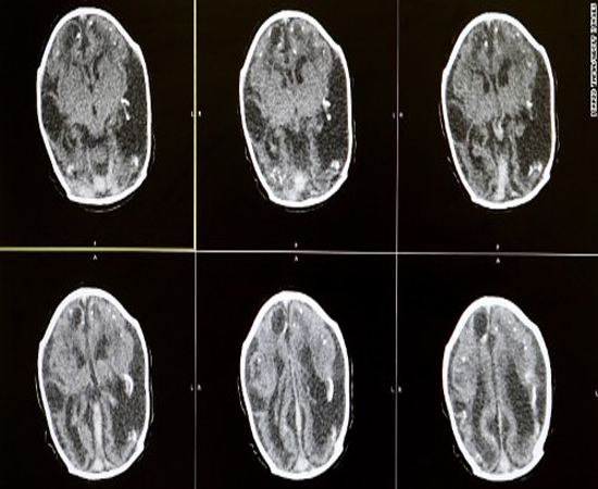 پنج چیز که باید از ویروس 