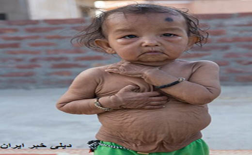 دختر و پسر بچه ای که پیرزن و پیرمرد هستند!