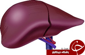 عوامل موثر در ایجاد سیروز كبدی