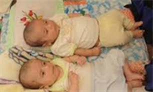 شناسایی دو نوزاد مبتلا به بیماری "فنیل کتونوری" در زاهدان