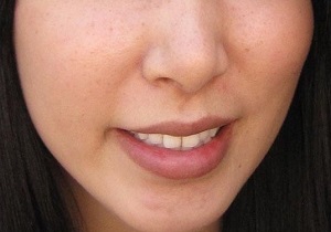 گونه هایتان را بدون جراحی و هزینه برجسته و زیبا کنید
