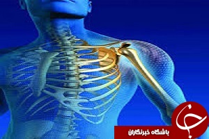سلامت استخوان های خود را با ورزش تضمین کنید