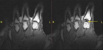 رشد گل در فضا/ عبور آلودگی هوا از پوست/ طراحی لباسی برای پیشگیری از سرطان