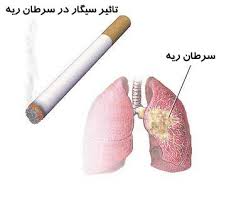 یزددرردیف سه استان آمارمبتلایان به سرطان