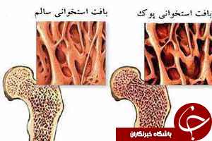 بارداری و تاثیر آن بر پوكی استخوان