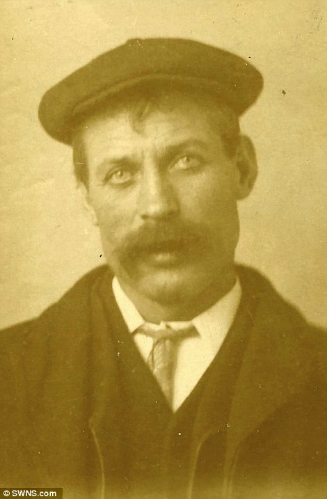 تب سلفی درسال 1910