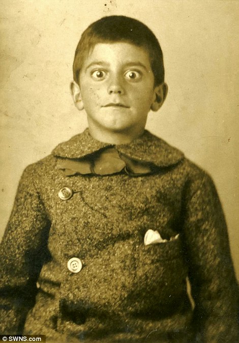 تب سلفی درسال 1910