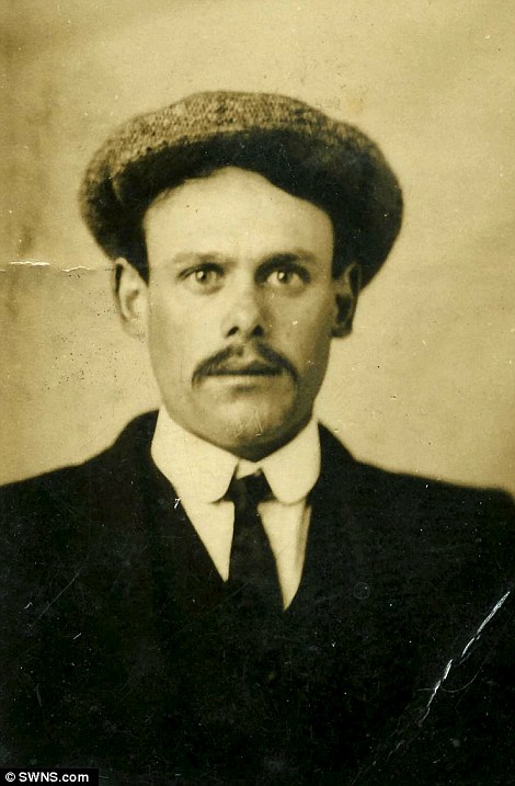 تب سلفی درسال 1910