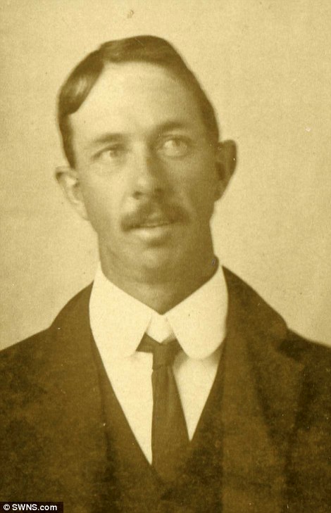تب سلفی درسال 1910