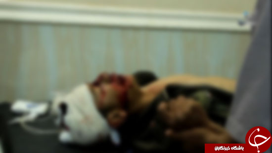 زخمی شدن کودکان بر اثر بمباران هواپیماهای ائتلاف ضد داعش+ تصاویر 18+
