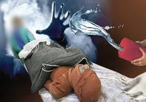 سرقت تنها انگیزه اسیدپاش زن&zwnj; نما