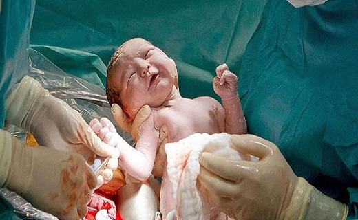 اولین زایمان طبیعی، با حضور همسر