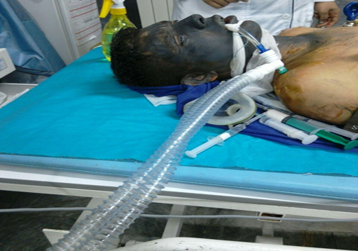 از قربانی شدن نوجوان قزوینی در انفجار موادمحترقه تا انفجار مشکوک منزل مسکونی /////////////