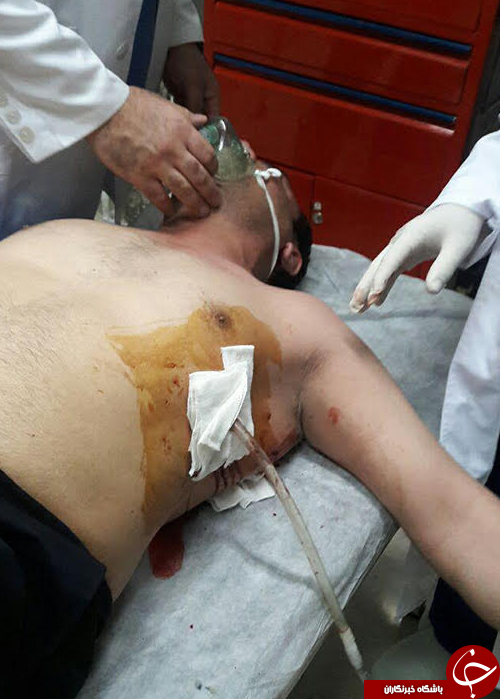 دو شهربان شهرداری با چاقوی قانون شكنان مجروح شدند/شهاب حسینی از ناحیه سینه آسیب دید+عكس