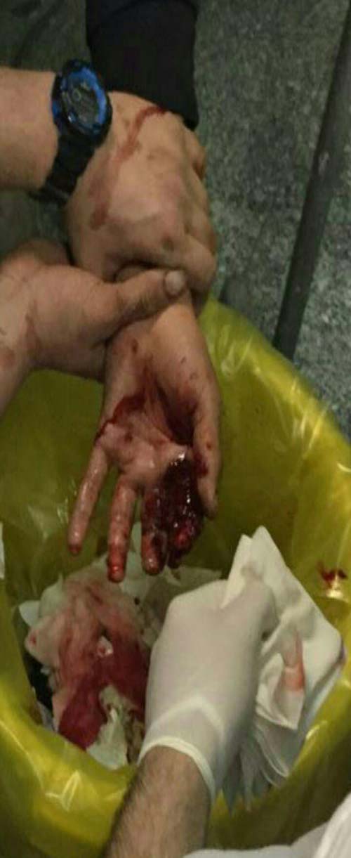 لحظه به لحظه با حواث چهارشنبه سوری در استان ها+تصاویر