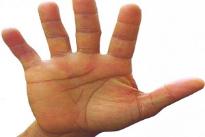 مچ بینی خطوط ویژه ازدواج + تصویر
