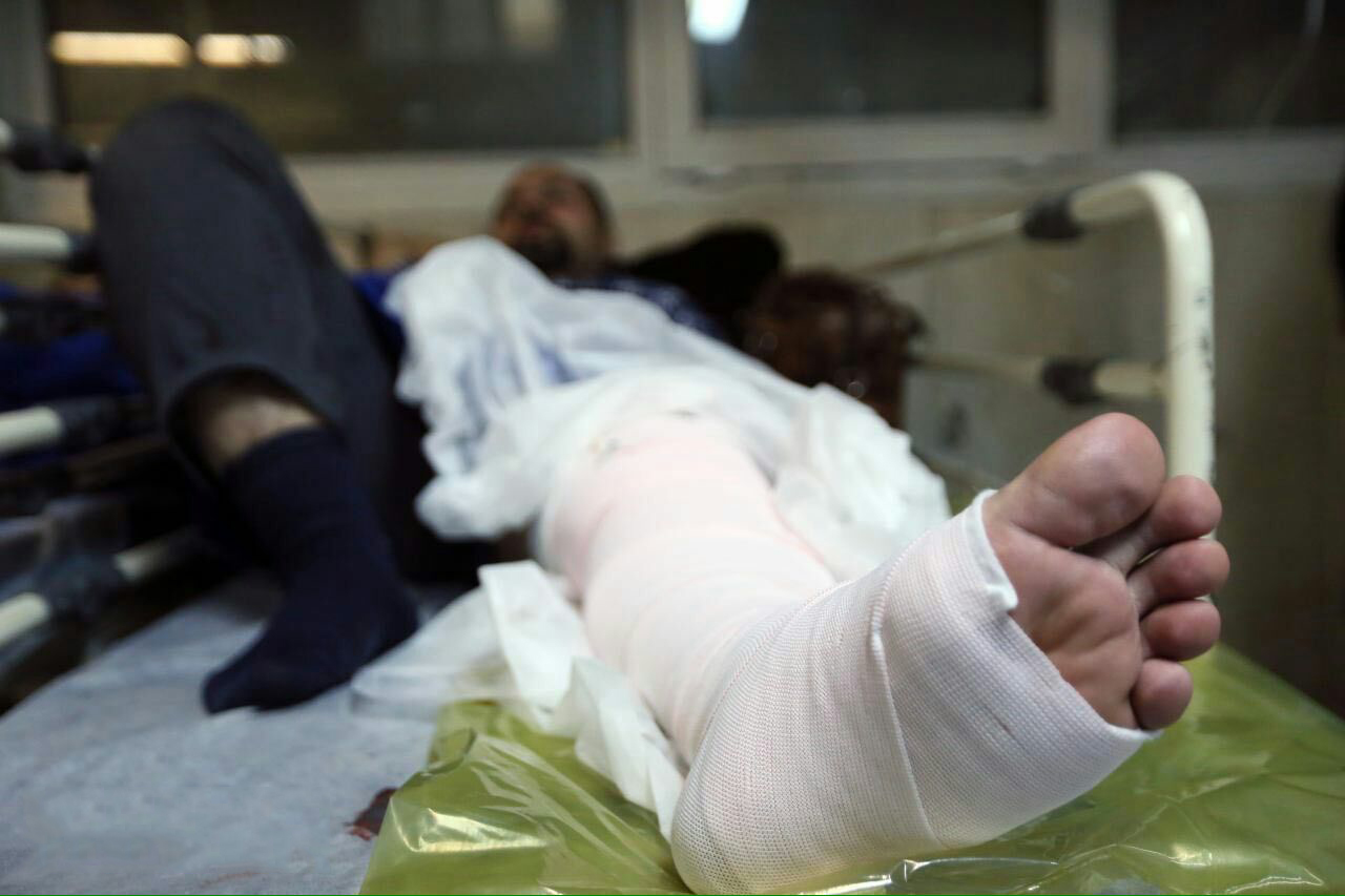 عیادت نماینده وزیر بهداشت و رئیس دانشگاه علوم پزشکی تهران از مصدومان حادثه انفجار بازار تهران