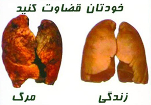 هشدارهای تصویری روی سیگارها با مغز افراد چه می‌کند؟