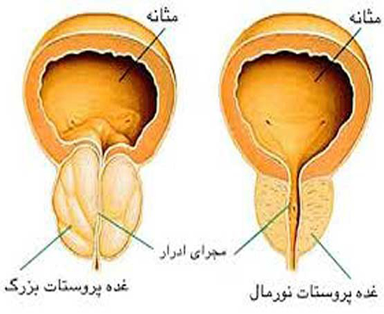 مردانی که به خاطر خجالت جان می‌دهند