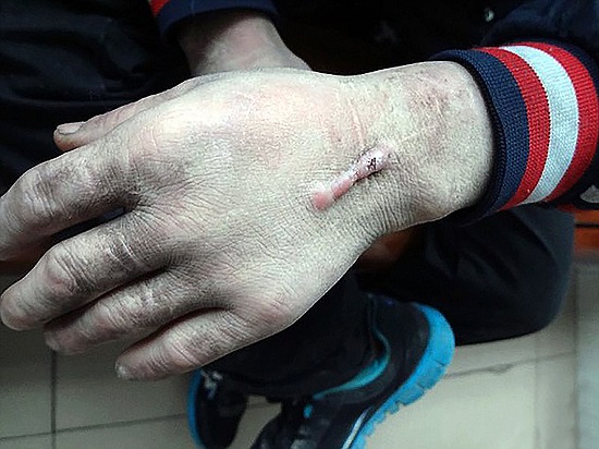 پایان 18 سال اسارت در اتاقی تاریک/ قربانی 34 ساله از شکنجه ها و آزارهای بیرحمانه می&zwnj;گوید