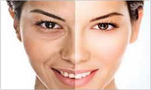 با بالا رفتن سن پوستی زیبا داشته باشید