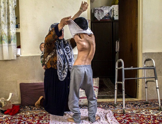 کلکسیون درد؛ دقایقی غم&zwnj;انگیز با یک کودک مبتلا به فلج مغزی + تصاویر