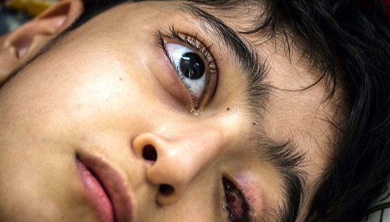 کلکسیون درد؛ دقایقی غم&zwnj;انگیز با یک کودک مبتلا به فلج مغزی + تصاویر
