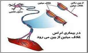 وجود 1400 بیمار ام‌اس در ‌استان کرمانشاه