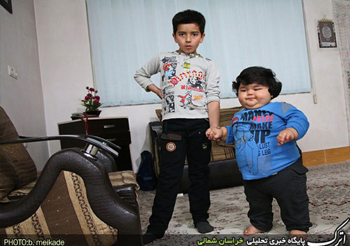 کودک یک ساله بجنوردی با ۴۲ کیلو وزن