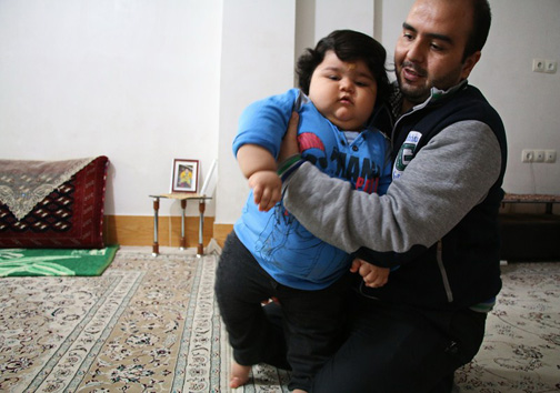 کودک یک ساله بجنوردی با ۴۲ کیلو وزن
