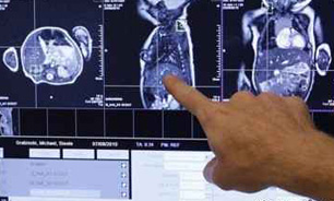 سنتز نانو ذرات جهت افزایش کنتراست وضوح تصاویر MRI