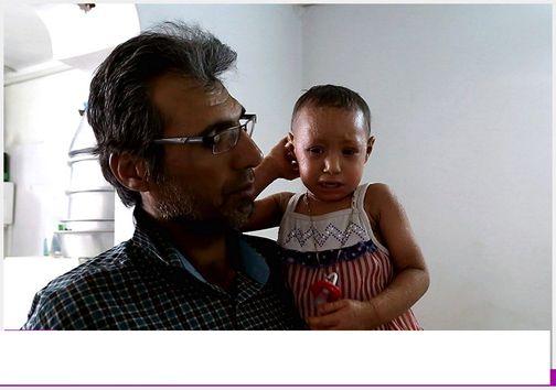 ملیکادختری که در پوست خود می&zwnj;سوزد +عکس