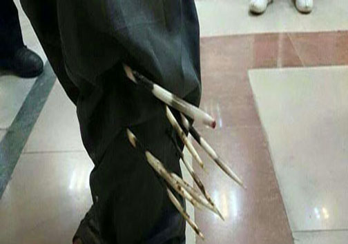حمله جوجه‌تیغی به کشاورز لرستانی (+عکس)