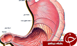 ابتلا به بیماری رفلاکس معده