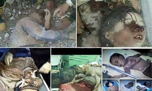آخرین آمار کشته‌ها و زخمی‌ها در یمن