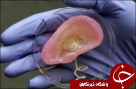 پرداخت کمک هزینه کاشت حلزون شنوایی به توانخواهان بهزیستی