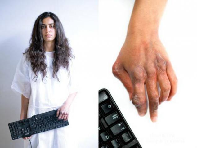 گیمرها به این بیماری گرفتار می شوند+تصاویر