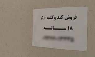 آگهی فروش کبد + فیلم