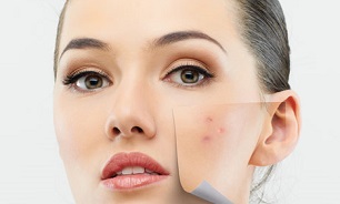چرا زلیخا جوش جوشی نبود؟