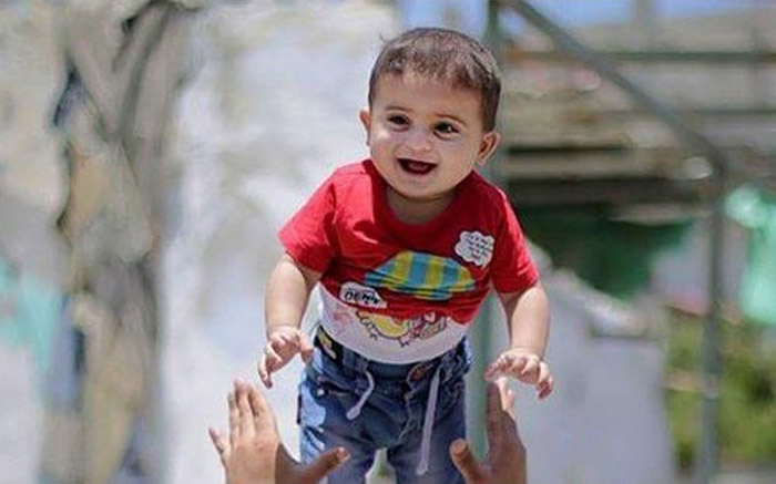 یکسال پس از معجزه برای کودک شیرخوار غزه +عکس