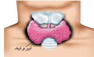خودایمنی تیروئید و کم بودن ید در نمک عوامل بیماری تیروئید