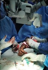 بازی دختر 2 ساله با چرخ گوشت حادثه آفرید