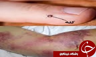 تب خونریزی دهنده کریمه کنگو در استان قزوین گزارش نشده است