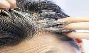 با این توصیه‌ها از بروز خزان موهایتان جلوگیری کنید