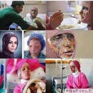 تحویل 4 تن از عاملان اسیدپاشی بوکان به مراجع قضایی