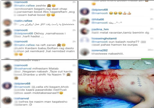 یک حادثه شرم آور در جامعه پزشکی؛ اینستاگرام بازی با بدن بیمار!