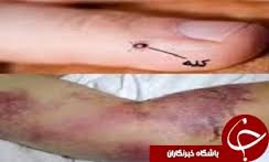 کنه آلوده، مهم ترین ناقل بیماری تب کریمه کنگو